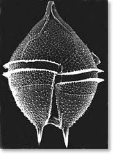 Protoperidinium steinii
